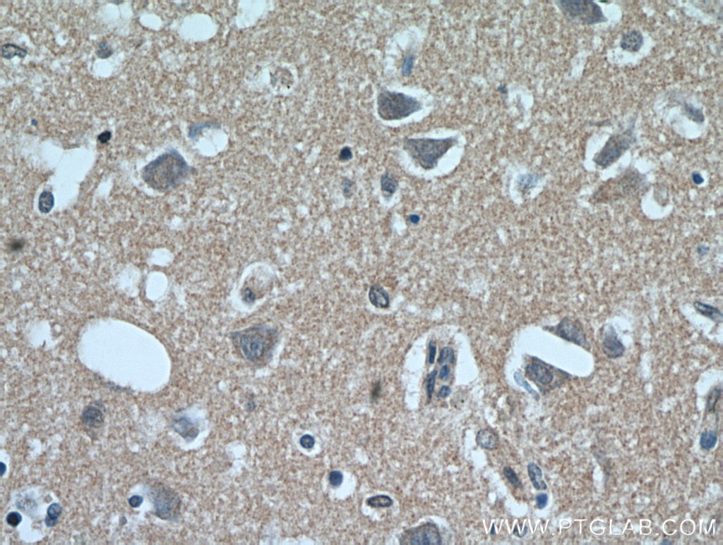 Immunohistochemistry (IHC) staining of human brain tissue using C1orf50 Polyclonal antibody (20957-1-AP)