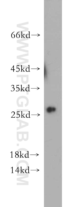 Western Blot (WB) analysis of HEK-293 cells using C1orf50 Polyclonal antibody (20957-1-AP)