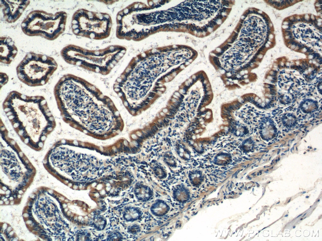 Immunohistochemistry (IHC) staining of human small intestine tissue using C1orf51/ CIART Polyclonal antibody (21098-1-AP)