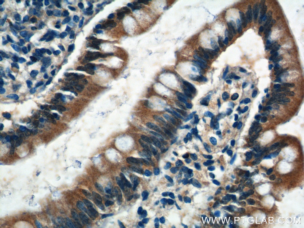 Immunohistochemistry (IHC) staining of human small intestine tissue using C1orf51/ CIART Polyclonal antibody (21098-1-AP)