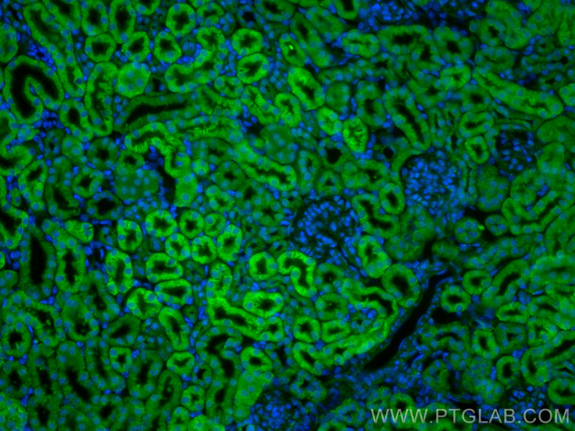 Immunofluorescence (IF) / fluorescent staining of mouse kidney tissue using C1orf54 Polyclonal antibody (30247-1-AP)