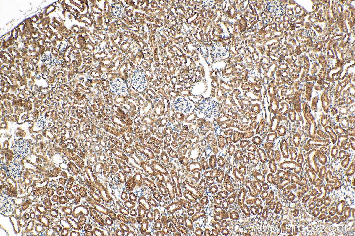 Immunohistochemistry (IHC) staining of mouse kidney tissue using C1orf54 Polyclonal antibody (30247-1-AP)