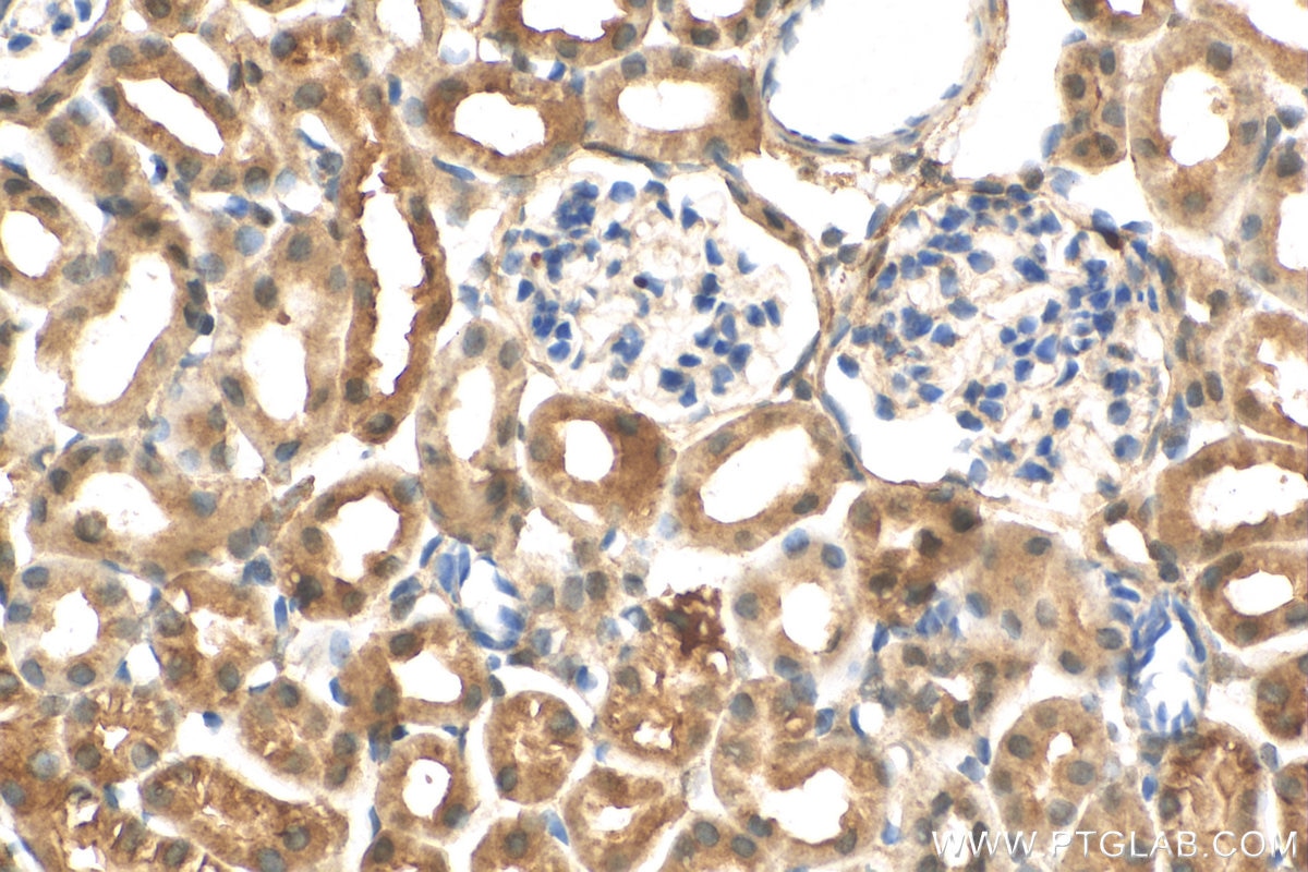 Immunohistochemistry (IHC) staining of mouse kidney tissue using C1orf54 Polyclonal antibody (30247-1-AP)