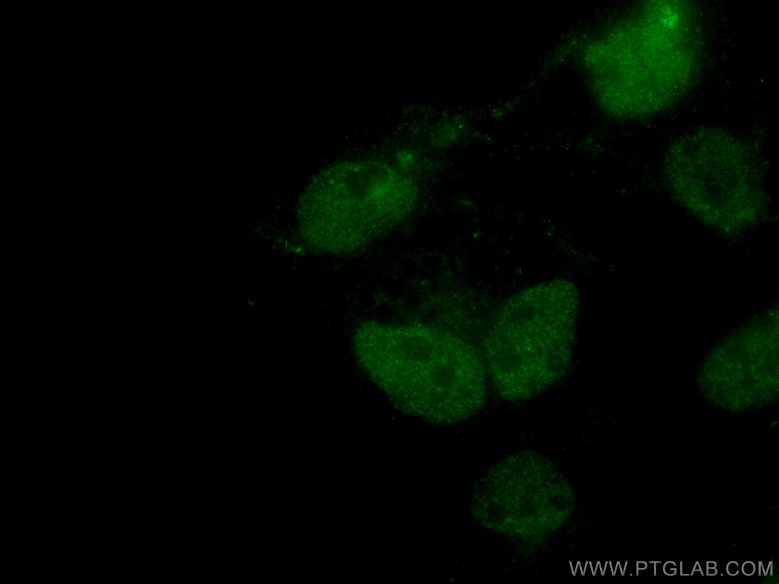 Immunofluorescence (IF) / fluorescent staining of A431 cells using C1orf58 Polyclonal antibody (26109-1-AP)