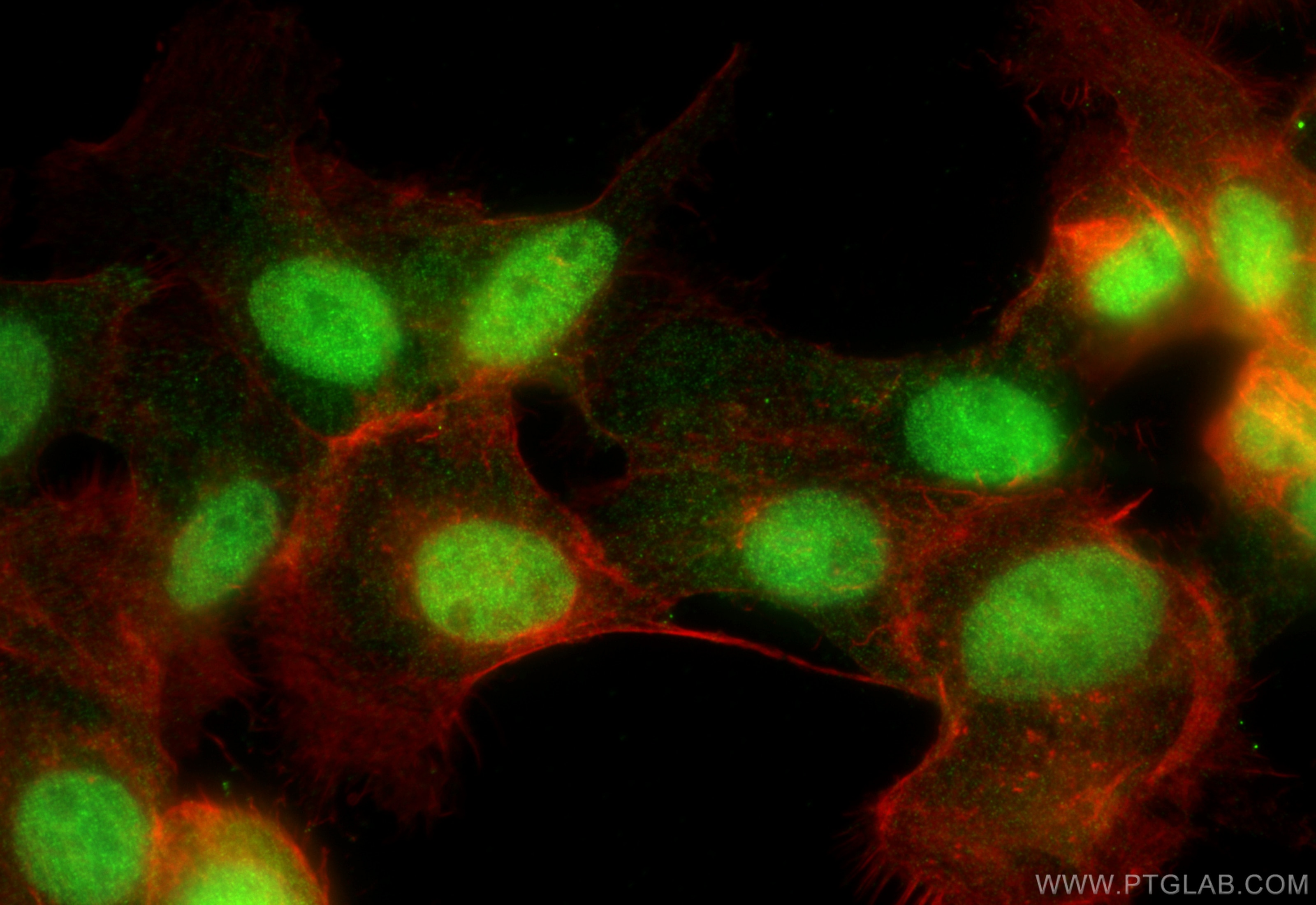Immunofluorescence (IF) / fluorescent staining of A431 cells using C1orf58 Polyclonal antibody (26109-1-AP)