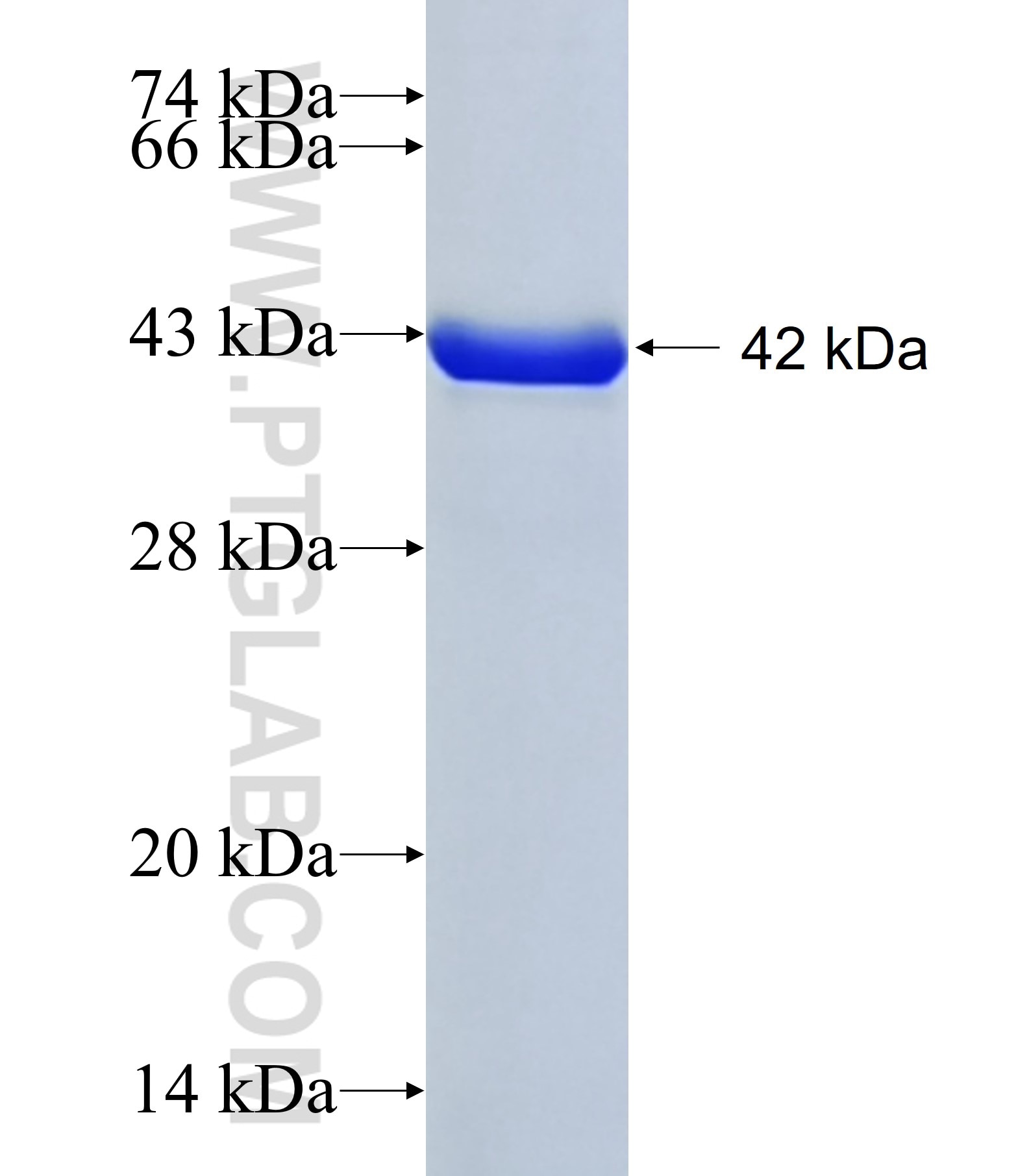 C1orf62 fusion protein Ag41865 SDS-PAGE