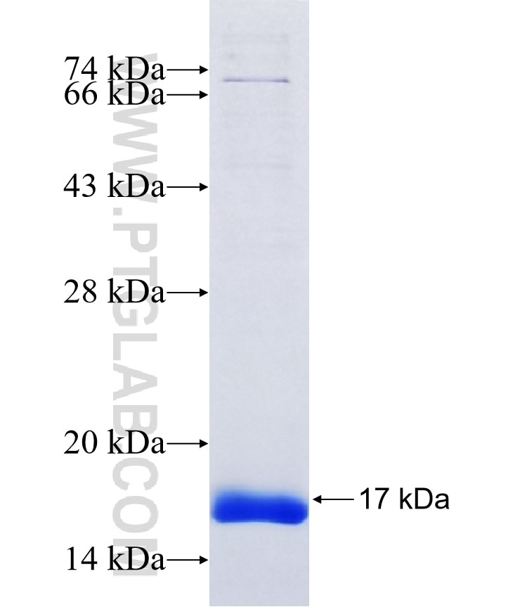 C1orf69 fusion protein Ag36706 SDS-PAGE
