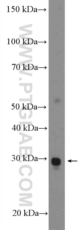 Western Blot (WB) analysis of mouse cerebellum tissue using C1orf71 Polyclonal antibody (26322-1-AP)