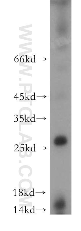 Western Blot (WB) analysis of mouse spleen tissue using C1orf77 Polyclonal antibody (21456-1-AP)