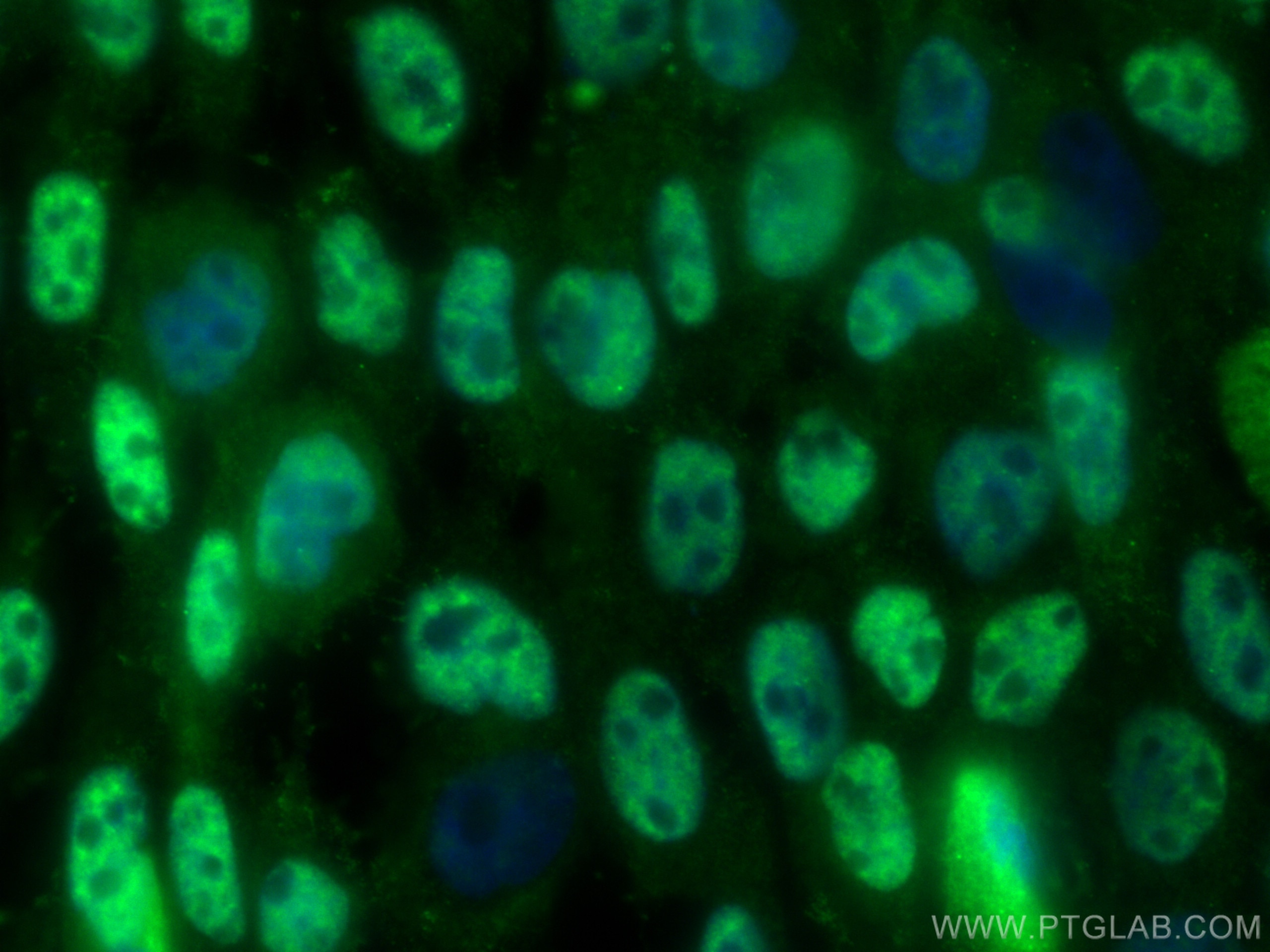 Immunofluorescence (IF) / fluorescent staining of A431 cells using C1orf77 Polyclonal antibody (27478-1-AP)