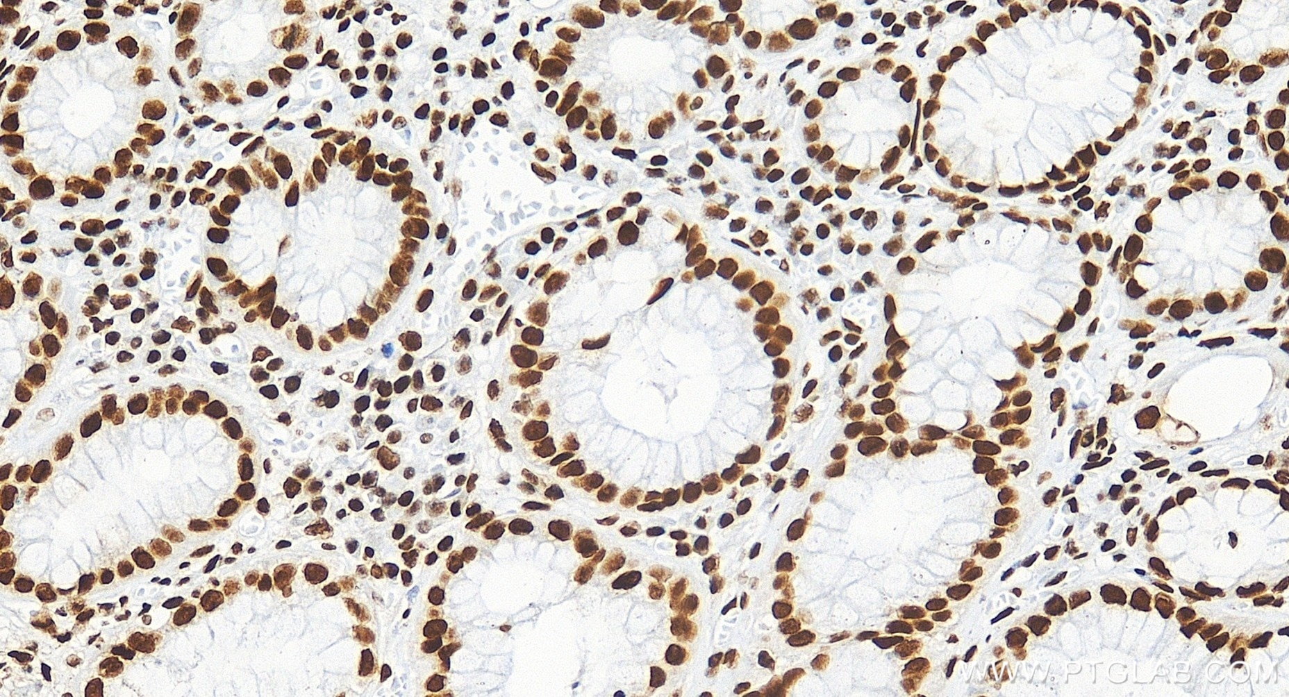 Immunohistochemistry (IHC) staining of human stomach tissue using C1orf77 Recombinant monoclonal antibody (85147-3-RR)
