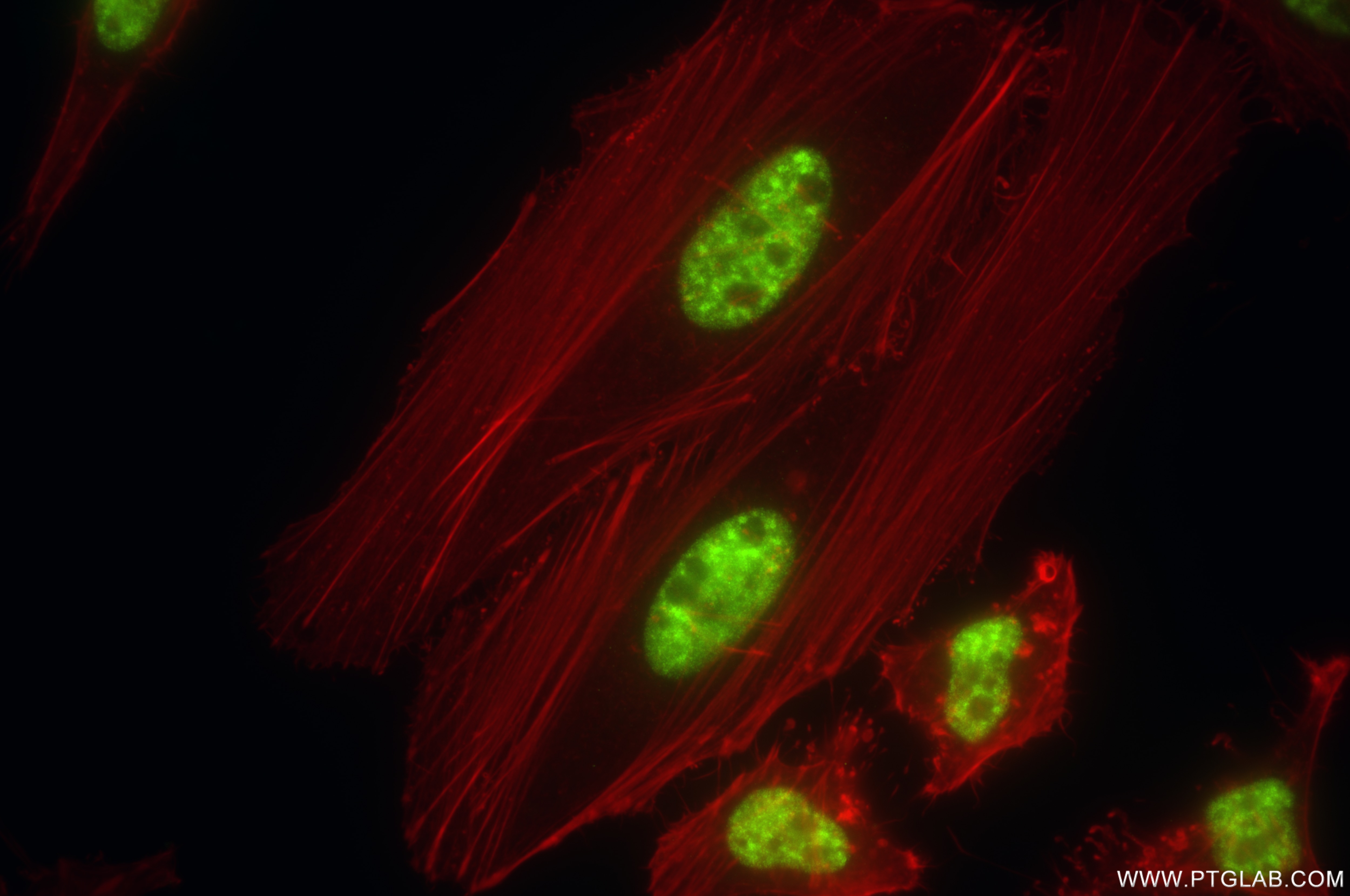 Immunofluorescence (IF) / fluorescent staining of HeLa cells using C1orf77 Recombinant antibody (85147-3-RR)