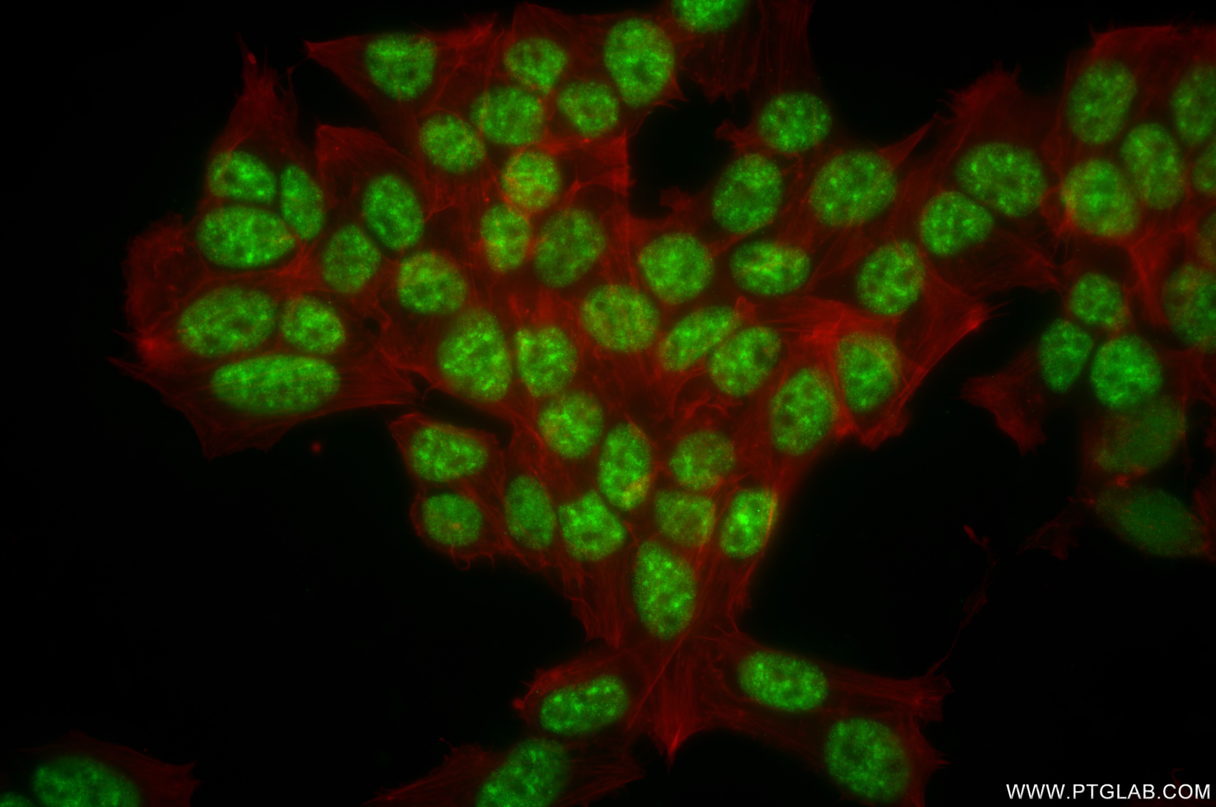 Immunofluorescence (IF) / fluorescent staining of SH-SY5Y cells using C1orf77 Recombinant antibody (85147-3-RR)