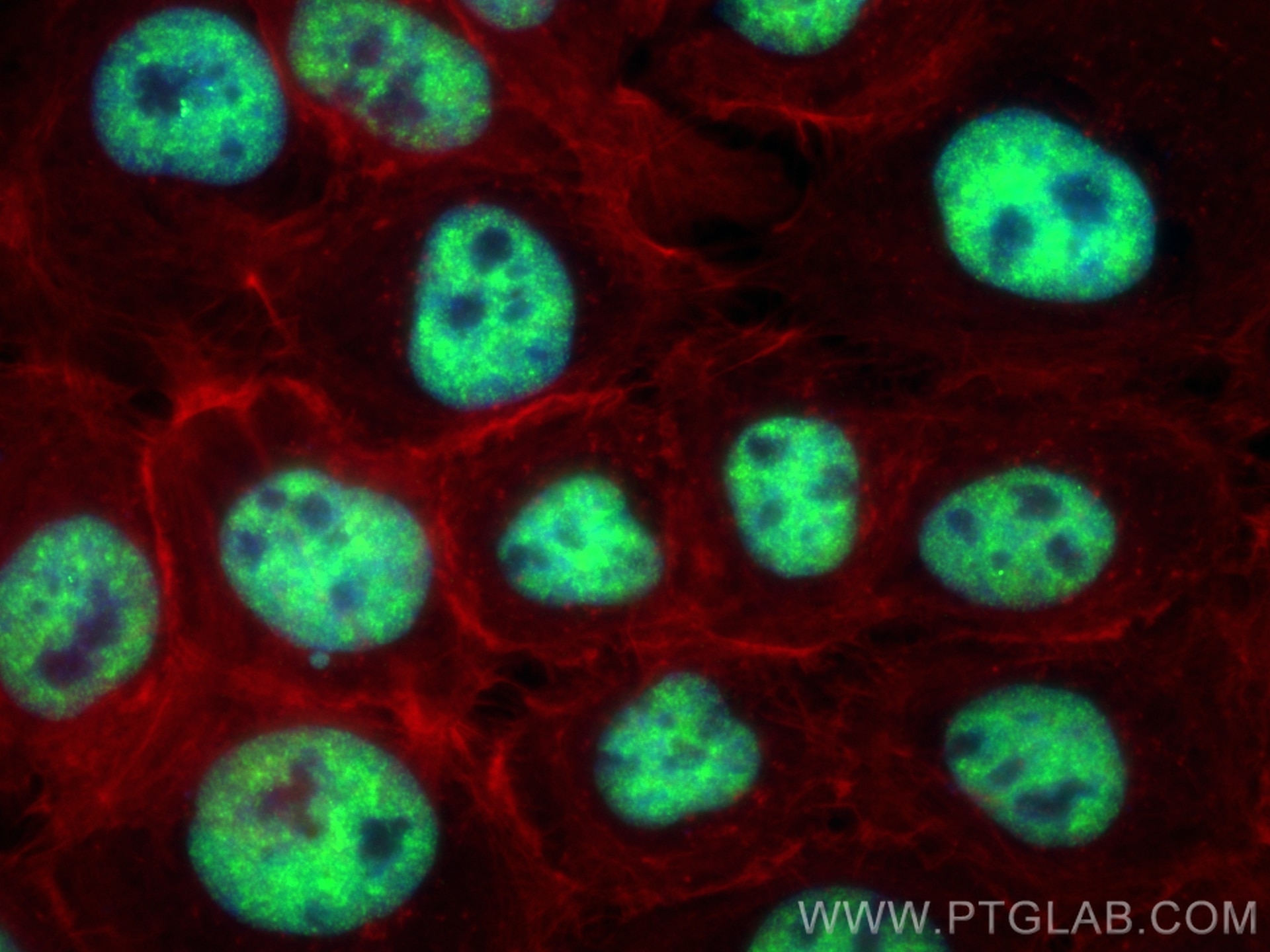 Immunofluorescence (IF) / fluorescent staining of A431 cells using C1orf77 Recombinant antibody (85147-3-RR)