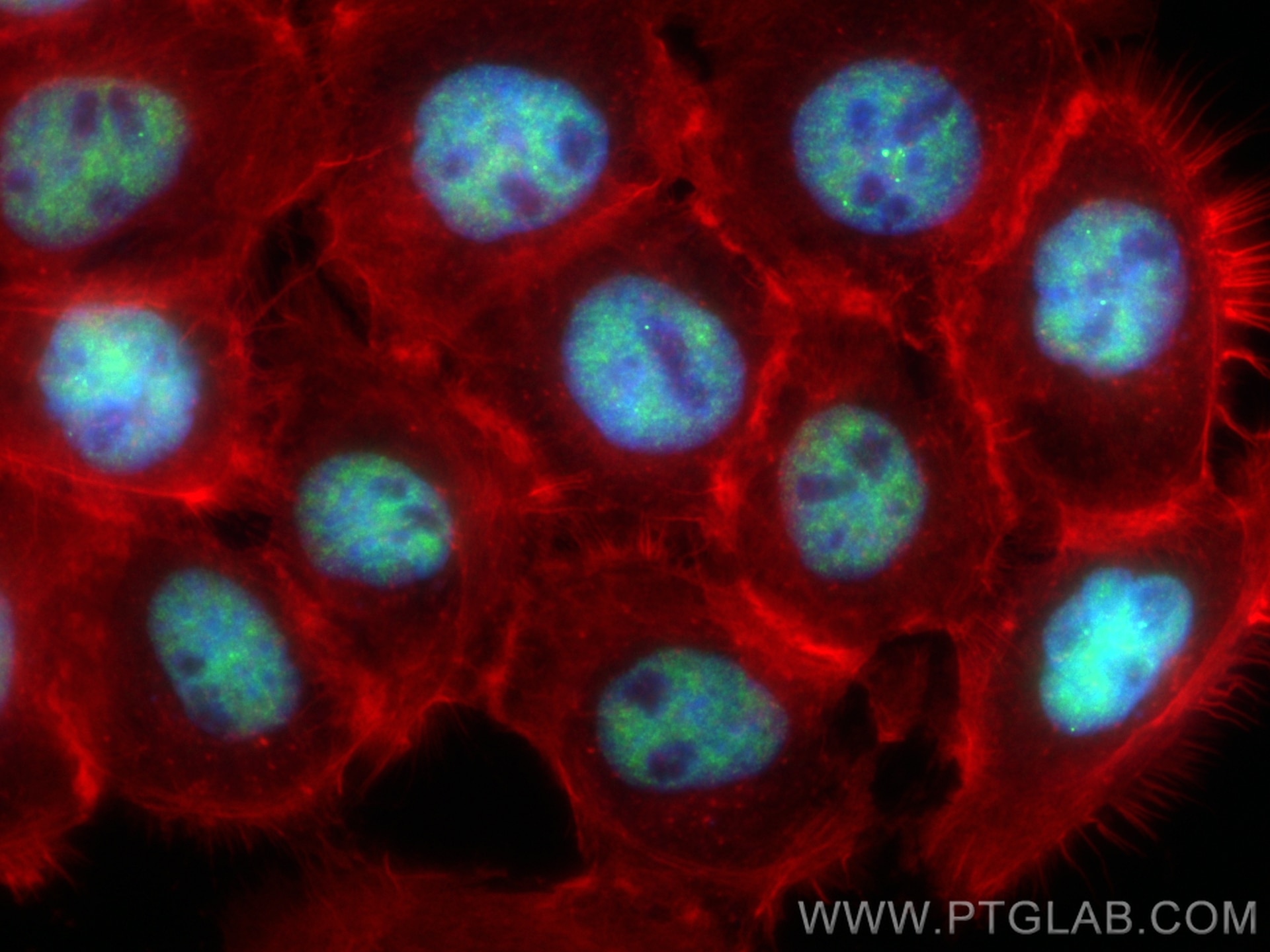 Immunofluorescence (IF) / fluorescent staining of A431 cells using CoraLite® Plus 488-conjugated C1orf77 Recombinant  (CL488-85147-3)