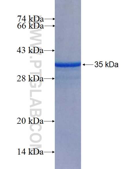 C1orf77 fusion protein Ag26580 SDS-PAGE