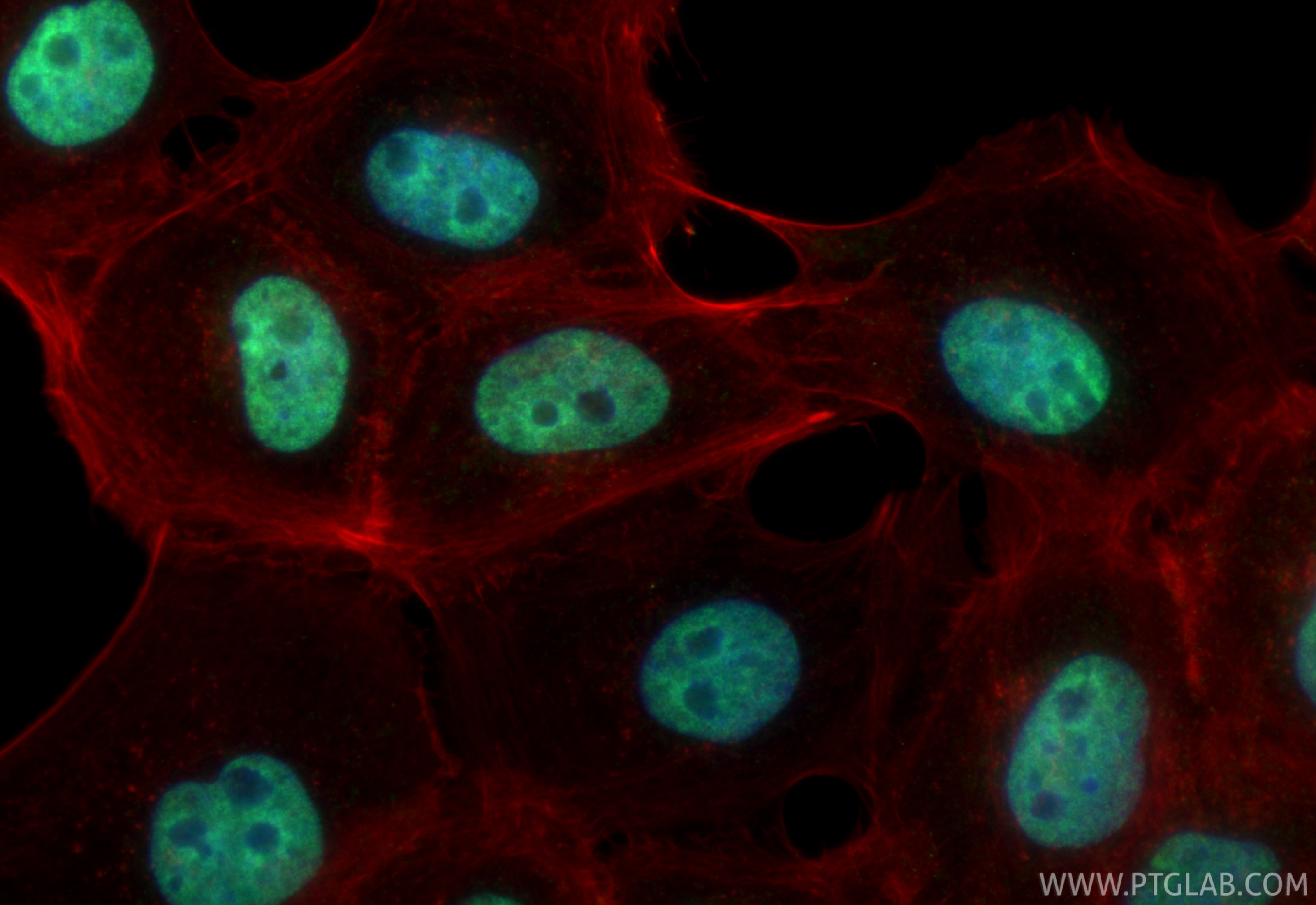 Immunofluorescence (IF) / fluorescent staining of A431 cells using C1orf83 Polyclonal antibody (20940-1-AP)