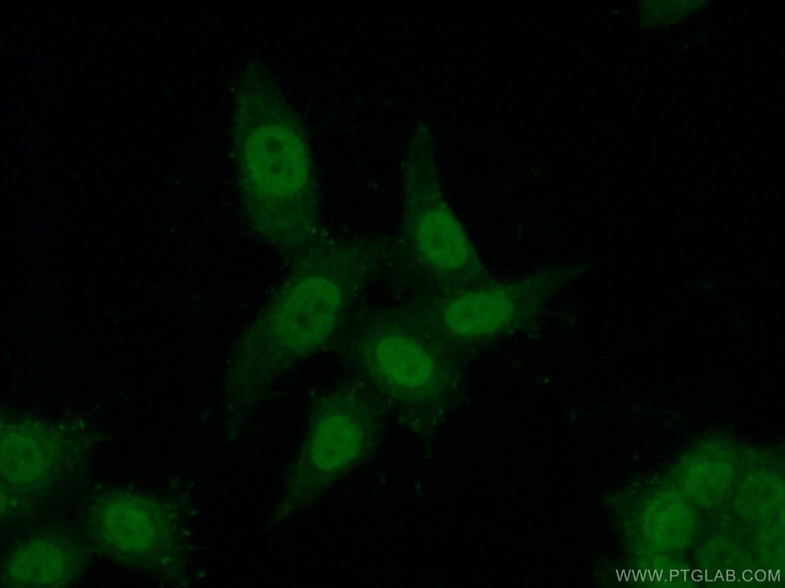 Immunofluorescence (IF) / fluorescent staining of HeLa cells using C1orf83 Polyclonal antibody (20940-1-AP)