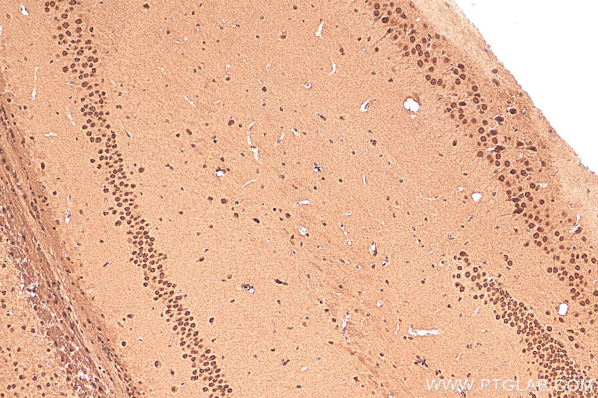 Immunohistochemistry (IHC) staining of mouse brain tissue using C1orf83 Polyclonal antibody (20940-1-AP)