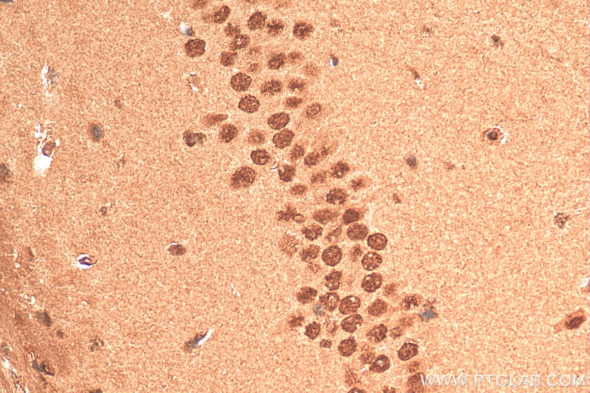 Immunohistochemistry (IHC) staining of mouse brain tissue using C1orf83 Polyclonal antibody (20940-1-AP)
