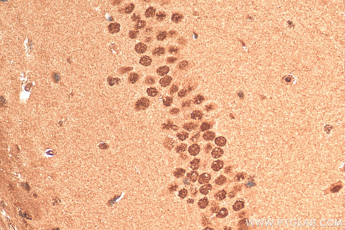 IHC staining of mouse brain using 20940-1-AP