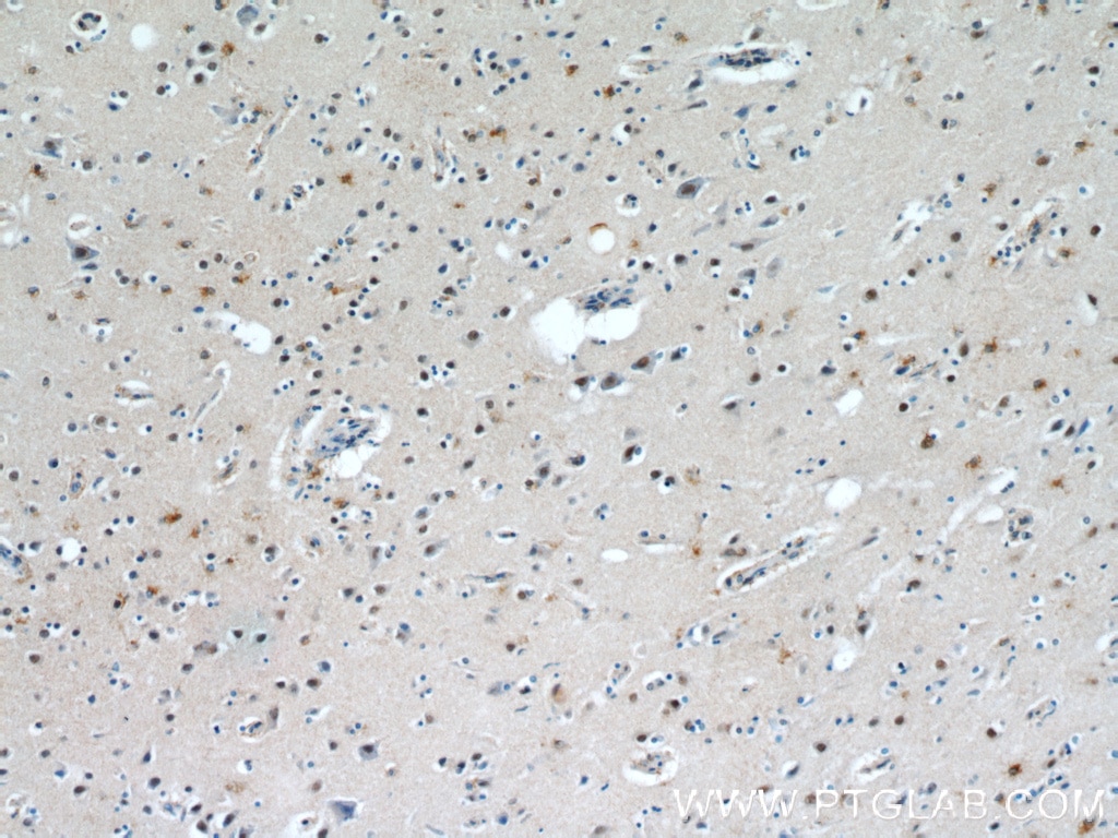 IHC staining of human brain using 20940-1-AP