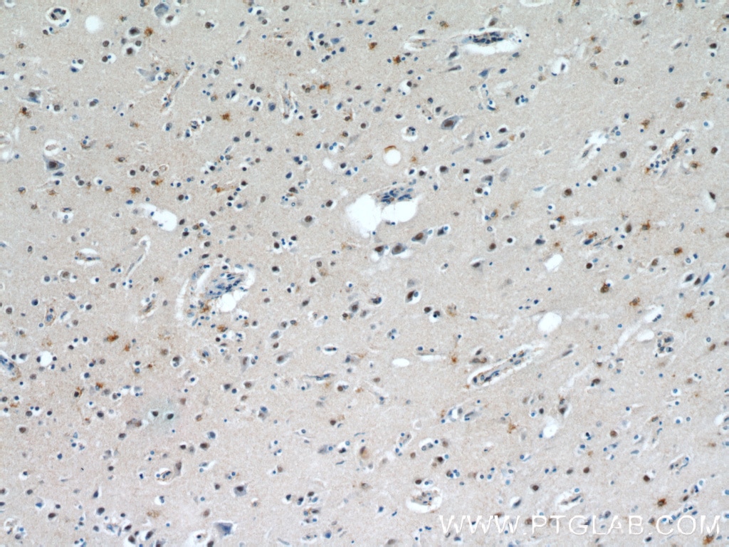 Immunohistochemistry (IHC) staining of human brain tissue using C1orf83 Polyclonal antibody (20940-1-AP)