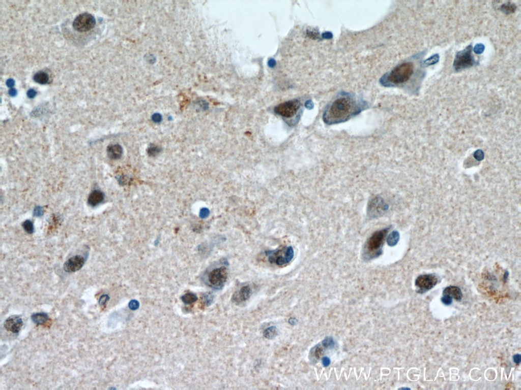 Immunohistochemistry (IHC) staining of human brain tissue using C1orf83 Polyclonal antibody (20940-1-AP)