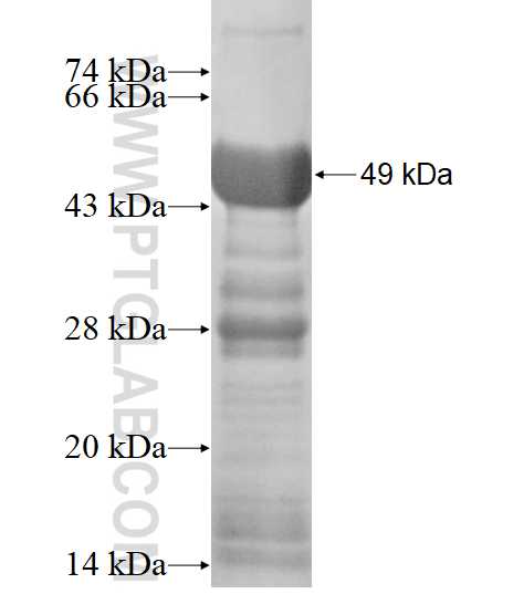 C1orf83 fusion protein Ag15040 SDS-PAGE