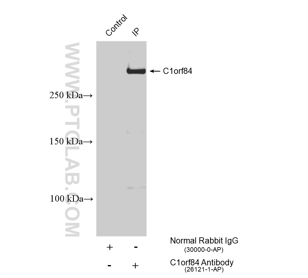 Immunoprecipitation (IP) experiment of THP-1 cells using C1orf84 Polyclonal antibody (26121-1-AP)