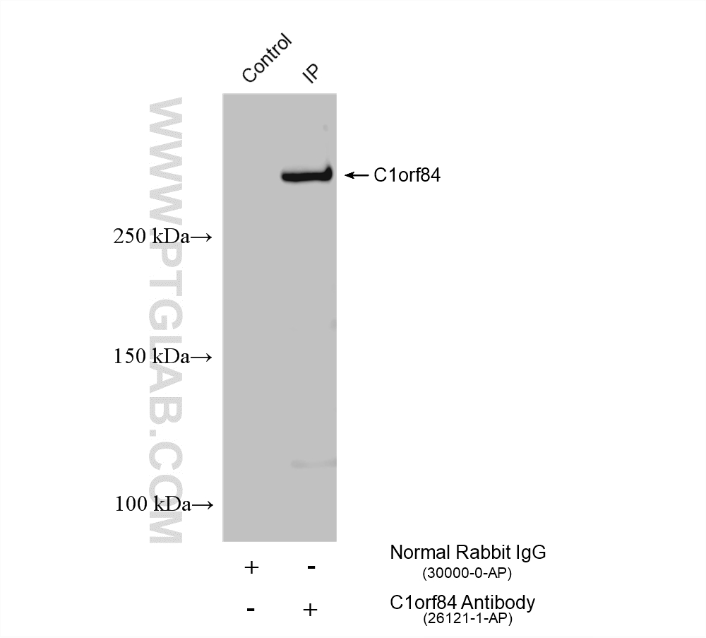 Immunoprecipitation (IP) experiment of HL-60 cells using C1orf84 Polyclonal antibody (26121-1-AP)