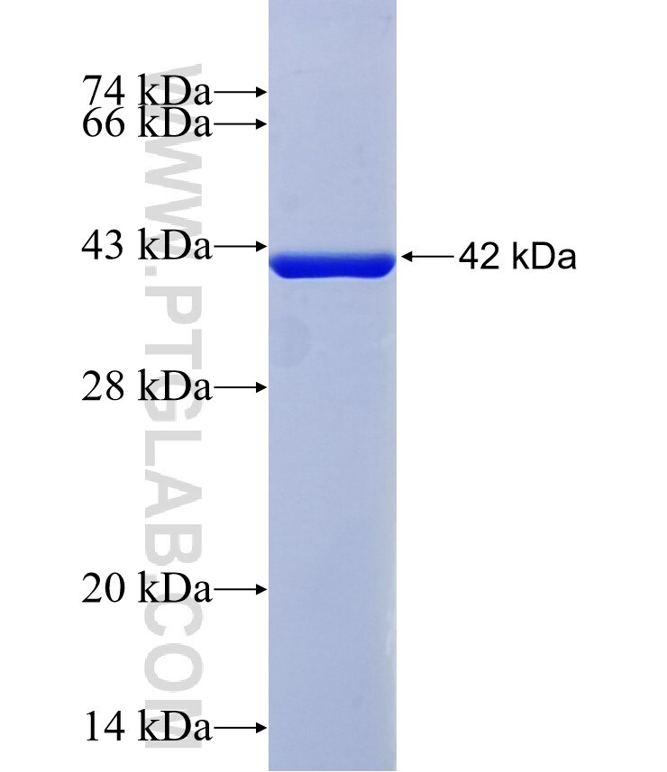 C1orf84 fusion protein Ag36664 SDS-PAGE C1orf84 fusion protein Ag36664 SDS-PAGE