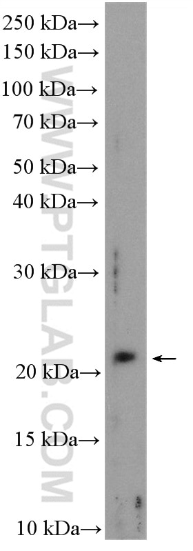 Western Blot (WB) analysis of K-562 cells using C1orf86 Polyclonal antibody (26138-1-AP)