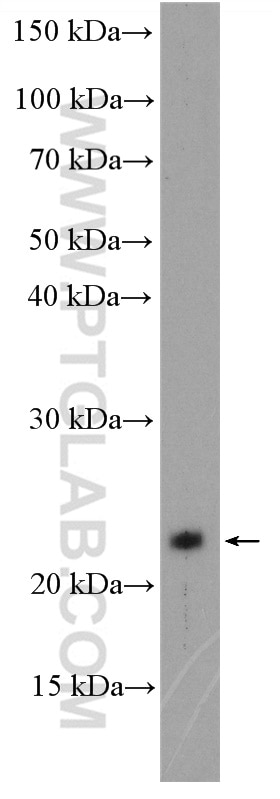 Western Blot (WB) analysis of A431 cells using C1orf86 Polyclonal antibody (26138-1-AP)