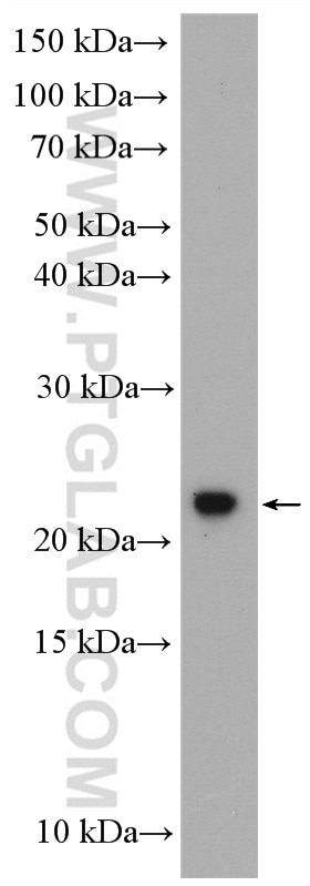 Western Blot (WB) analysis of A431 cells using C1orf86 Polyclonal antibody (26138-1-AP)