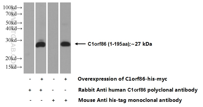 C1orf86