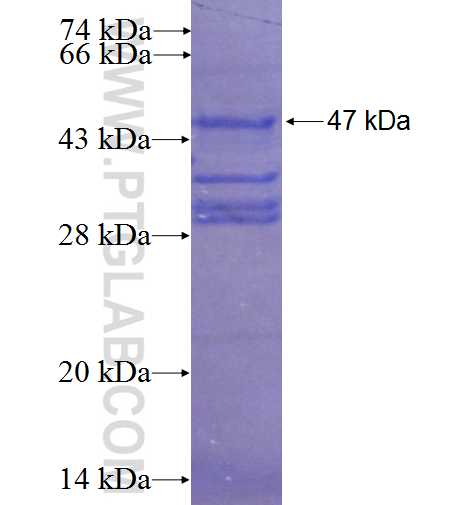 C1orf86 fusion protein Ag23534 SDS-PAGE