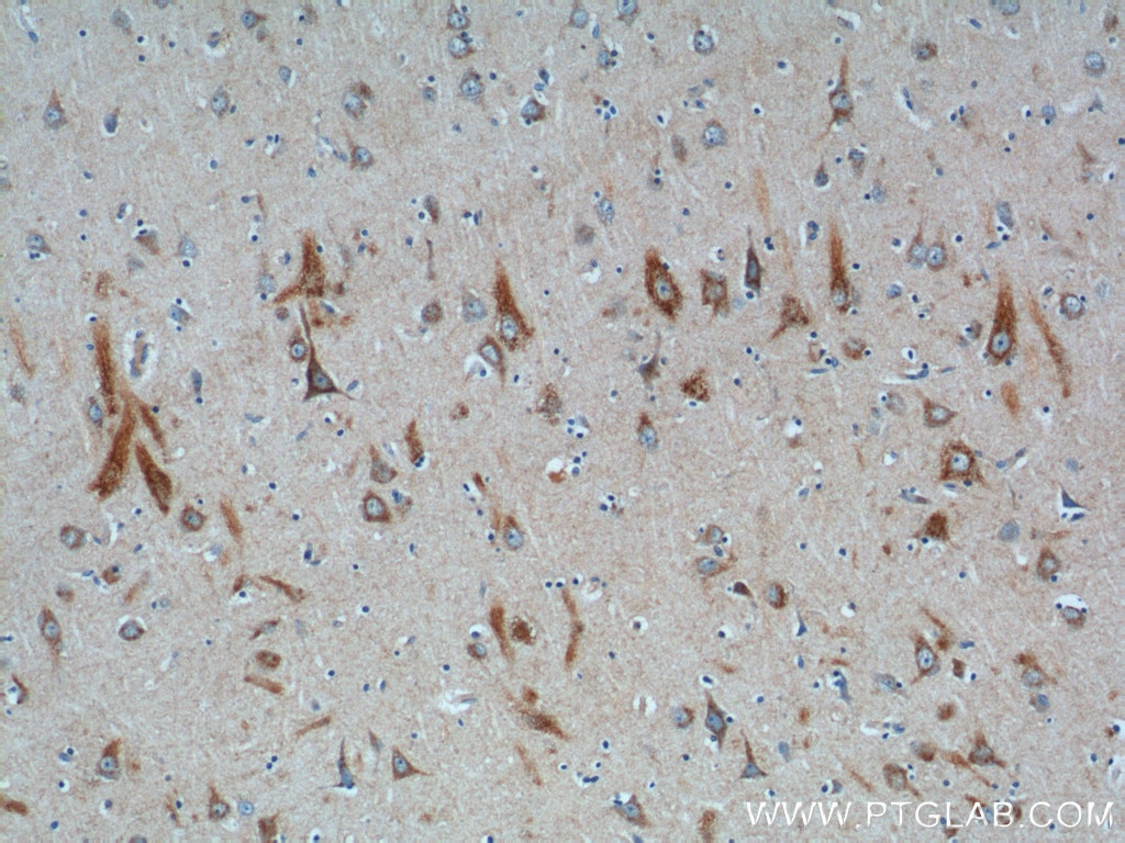 Immunohistochemistry (IHC) staining of human brain tissue using SUCO Polyclonal antibody (26074-1-AP)