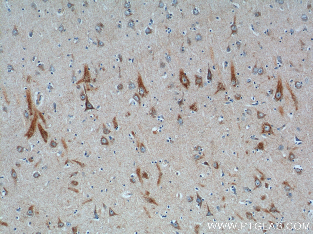 IHC staining of human brain using 26074-1-AP