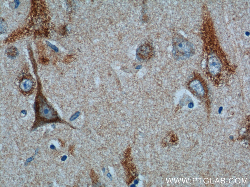 Immunohistochemistry (IHC) staining of human brain tissue using SUCO Polyclonal antibody (26074-1-AP)