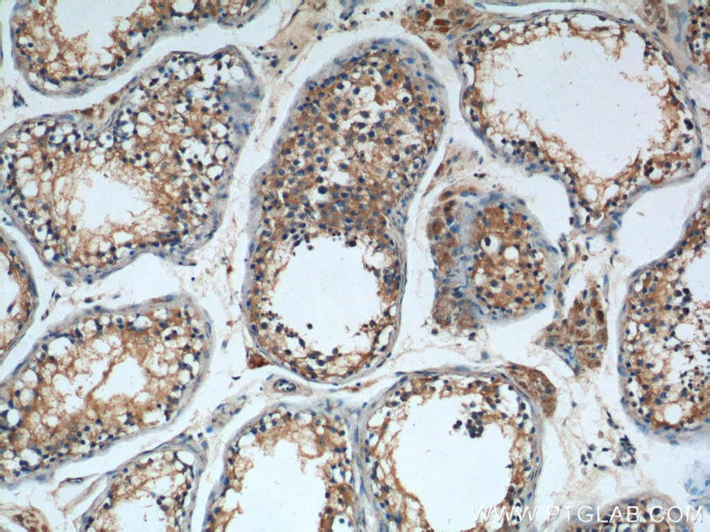 IHC staining of human testis using 26074-1-AP