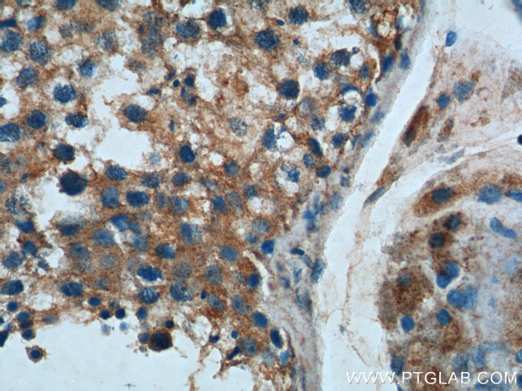 Immunohistochemistry (IHC) staining of human testis tissue using SUCO Polyclonal antibody (26074-1-AP)