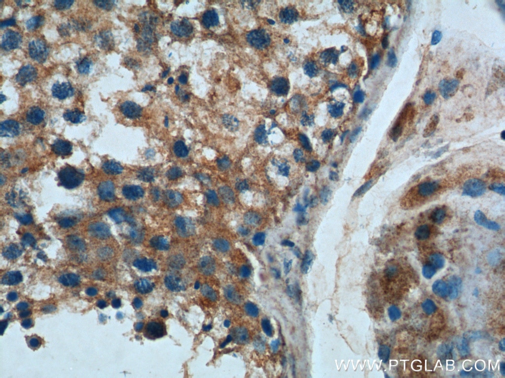 IHC staining of human testis using 26074-1-AP