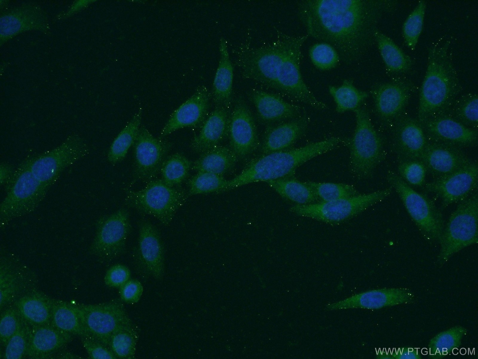 Immunofluorescence (IF) / fluorescent staining of HeLa cells using C1orf92 Polyclonal antibody (21031-1-AP)