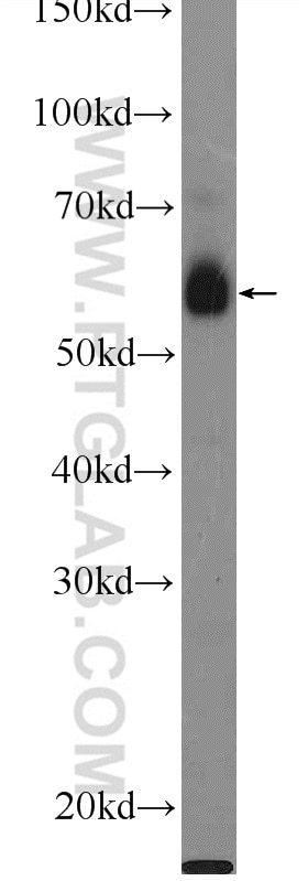 Western Blot (WB) analysis of HeLa cells using C1orf92 Polyclonal antibody (21031-1-AP)