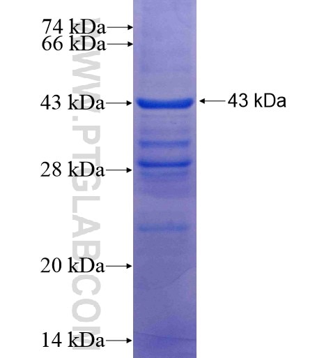C1orf92 fusion protein Ag15492 SDS-PAGE