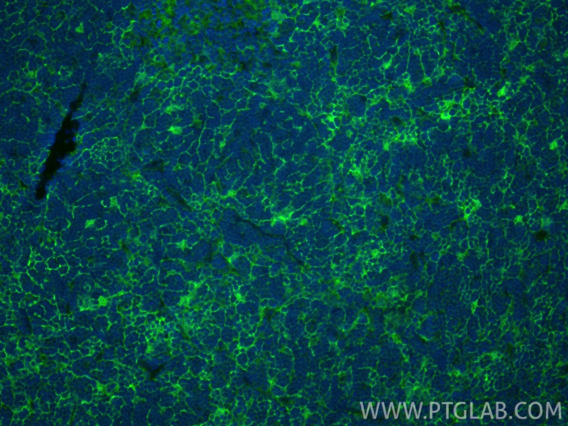 IF Staining of mouse thymus using 26304-1-AP Immunofluorescence (IF) / fluorescent staining of mouse thymus tissue using C1orf93 Polyclonal antibody (26304-1-AP)