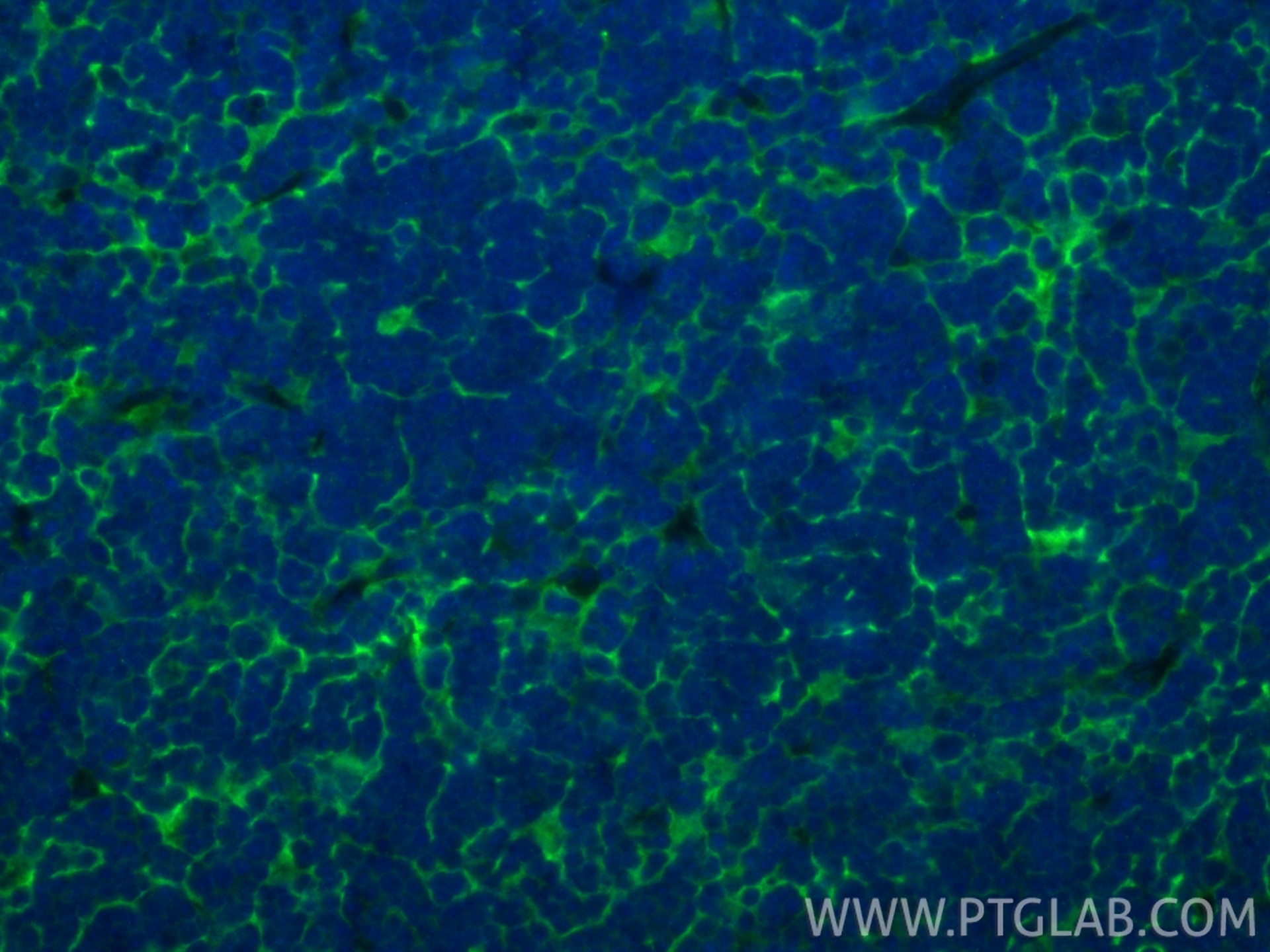 IF Staining of mouse thymus using 26304-1-AP Immunofluorescence (IF) / fluorescent staining of mouse thymus tissue using C1orf93 Polyclonal antibody (26304-1-AP)
