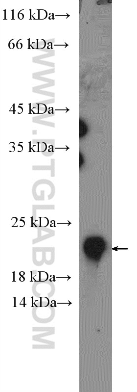 Western Blot (WB) analysis of MCF-7 cells using C1orf93 Polyclonal antibody (26304-1-AP)