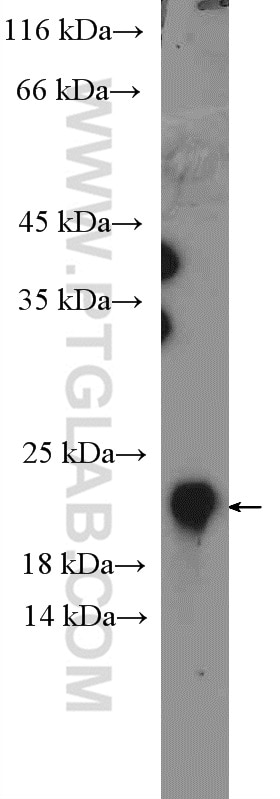 WB analysis of MCF-7 using 26304-1-AP